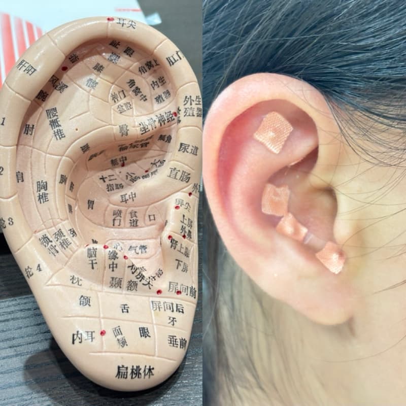 👂台北古亭站|徵耳穴體驗模特