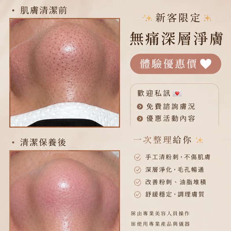 毛孔深層大掃除→ 體驗價$999