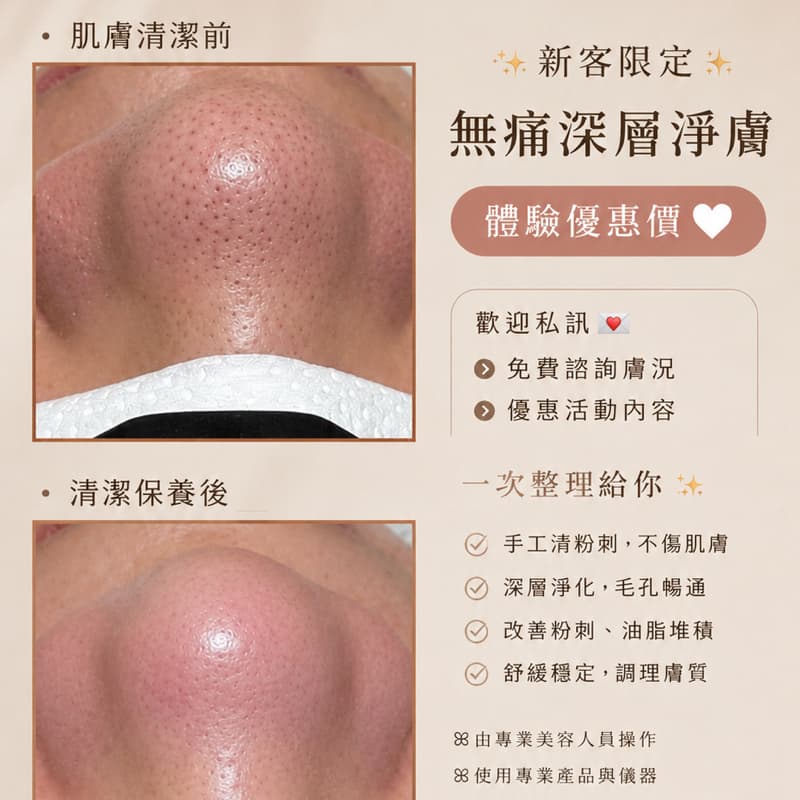 毛孔深層大掃除→ 體驗價$999